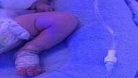 انجام پروسیجر های PICC در بخش NICU مرکز آموزشی درمانی پزوهشی امیرالمومنین (ع)